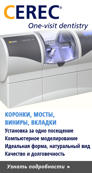 CEREC CAD-CAM Treatements in Cyprus