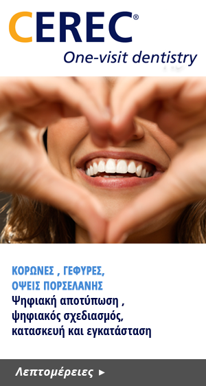 κορώνες , γέφυρες,
όψεις πορσελάνης