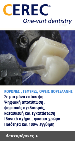 κορώνες , γέφυρες,
όψεις πορσελάνης